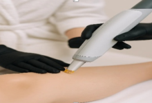 Laser hair removal: Why more women and men are choosing it