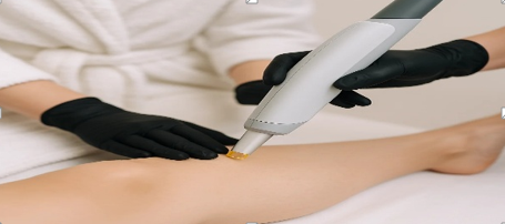 Laser hair removal: Why more women and men are choosing it