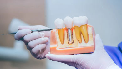 4 Common Treatments Offered In Periodontics And Implant Dentistry